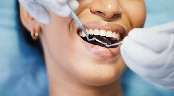 Best Cracked Tooth Emergency Dentist  in Union, KY